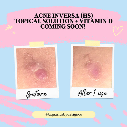 Acne Inversa Topical Solution Calming Gel